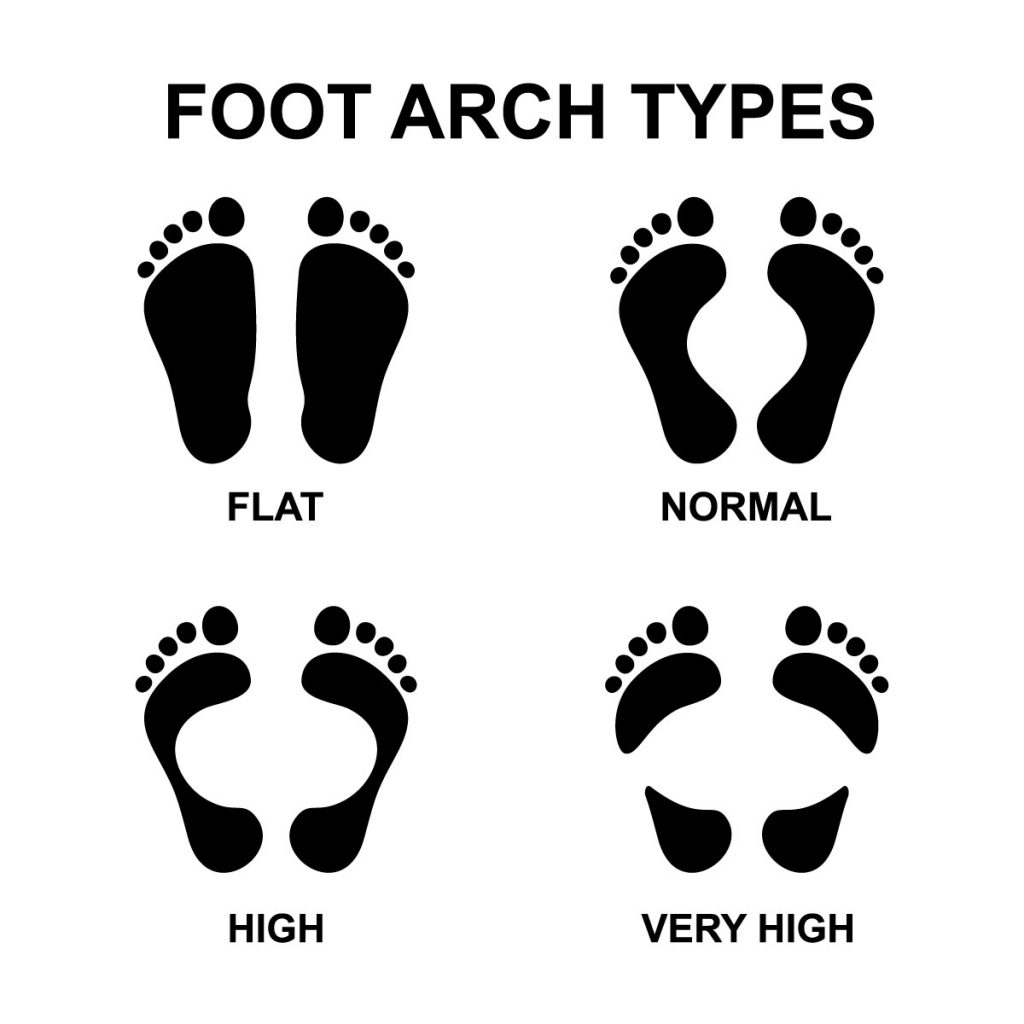 shoes for men with high arches